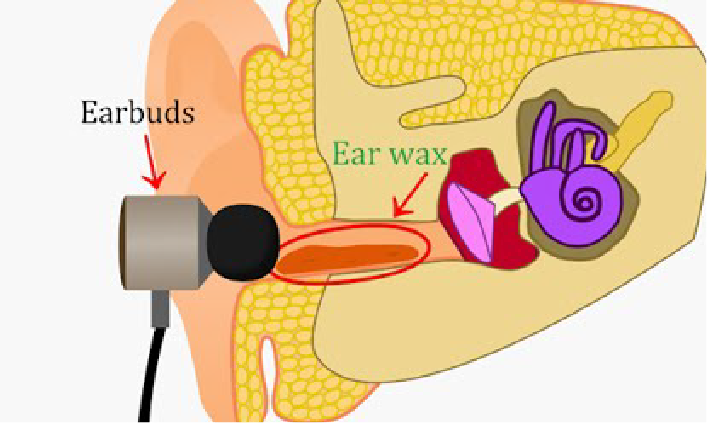 Як навушники порушують ваше слухання